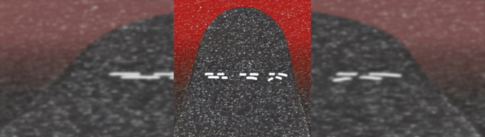 KIup zu dem Beitrag Wellcode